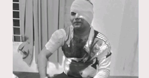 जेन जी आन्दोलनसँग संलग्न भएको आरोपमा एकजनामाथि खुकुरी प्रहार